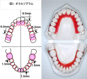 オクルゾグラム