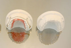 (5)　治療終了・保定メンテナンス